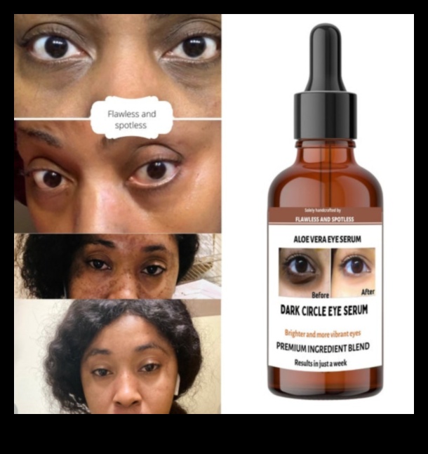 Ādas kopšana tumšajiem lokiem 7 stratēģijas, lai padarītu gaišāku acu zonu 4 Ādas kopšana tumšiem lokiem: stratēģijas acu zonas paspilgtināšanai