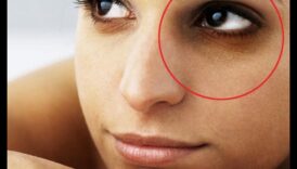 Ādas kopšana tumšiem lokiem: stratēģijas acu zonas paspilgtināšanai