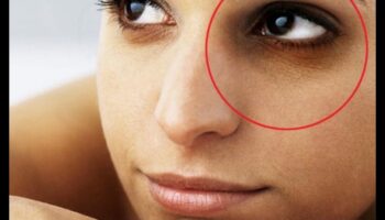 Ādas kopšana tumšiem lokiem: stratēģijas acu zonas paspilgtināšanai